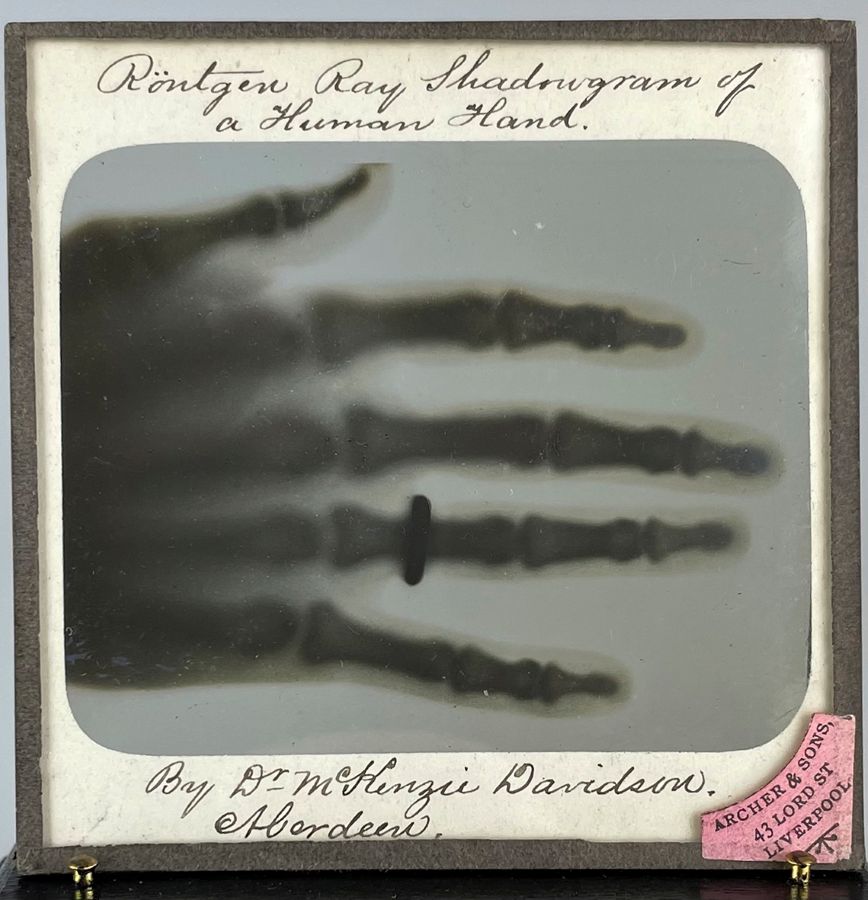 One of the earliest X-Rays