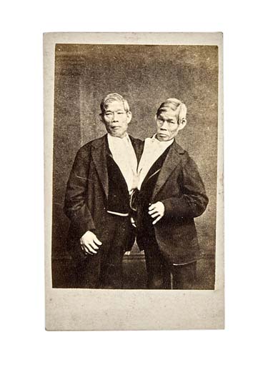 The Bunker Brothers - from where the name Siamese Twins come froms.jpg